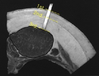 모돈의 등지방. 출처: Total Backfat and Individual Backfat Layer Changes of Primiparous Sows During Late Gestation and Lactation