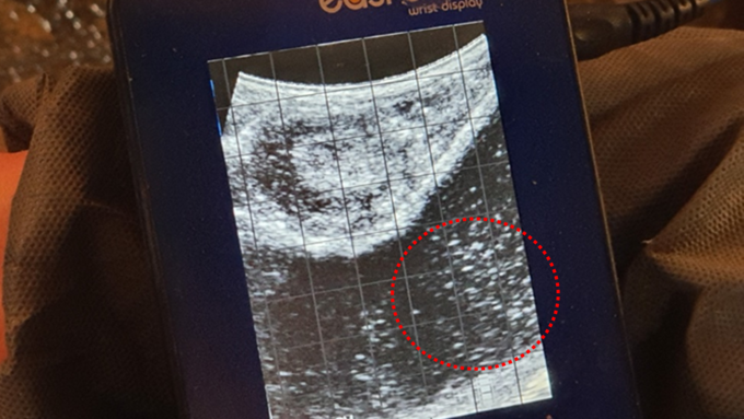 초음파을 통해 본 모돈의 방광 내 상당량의 부유물이 확인되고 있다(Hyper echoic한 초음파 영상)