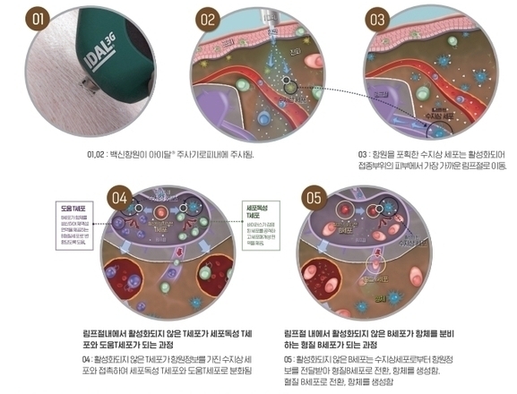 아이달3G 피내 접종 및 면역 유발 과정@엠에스디