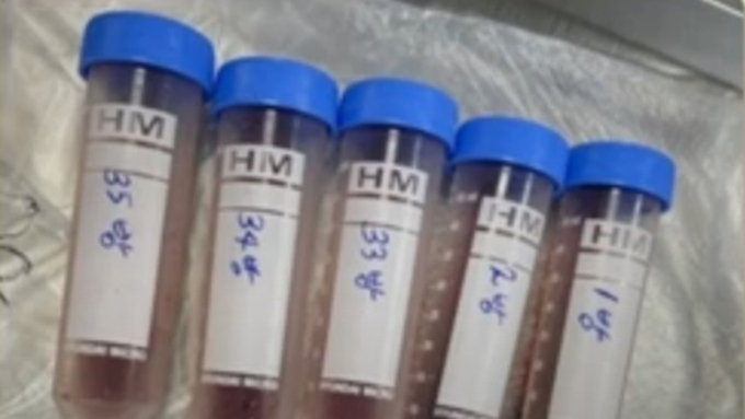 [동영상] 신속하고 정확한 가검물 결과 얻으려면