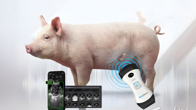 "비전문가도 임신진단 판독"… 엠트리센, AI 임신진단 시스템 ‘딥소닉’ 3월 출시 예고